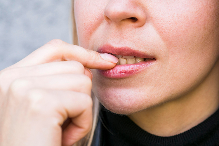 خشکی دهان (زروستومیا)